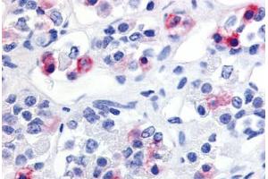 Human Anterior Pituitary (formalin-fixed, paraffin-embedded) stained with PRLHR antibody ABIN213447 at 20 ug/ml followed by biotinylated goat anti-rabbit IgG secondary antibody ABIN481713, alkaline phosphatase-streptavidin and chromogen. (PRLHR antibody  (Extracellular Domain))