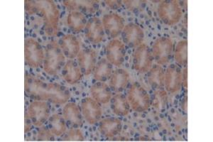 Detection of b2M in Mouse Kidney Tissue using Monoclonal Antibody to Beta-2-Microglobulin (b2M) (beta-2 Microglobulin antibody  (AA 22-119))