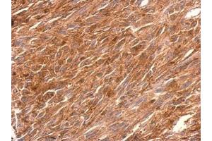 IHC-P Image PGCP antibody detects PGCP protein at cytosol on U373 xenograft by immunohistochemical analysis. (CPQ antibody)