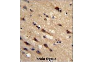 Formalin-fixed and paraffin-embedded human brain tissue reacted with IC Antibody (Center), which was peroxidase-conjugated to the secondary antibody, followed by DAB staining. (PPIC antibody  (AA 61-89))