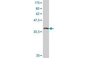 Western Blot detection against Immunogen (36. (UBE2B antibody  (AA 63-152))