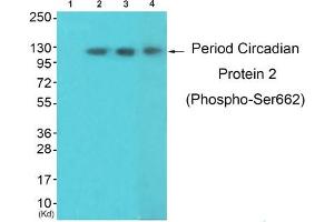 Western blot analysis of extracts from 3T3lbnotHeLa and K562 cells, using Period Circadian Protein 2 (Phospho-Ser662) Antibody. (PER2 antibody  (pSer662))