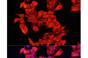 Immunofluorescence analysis of HeLa cells using AOC1 Polyclonal Antibody at dilution of 1:100 (40x lens). (DAO antibody)