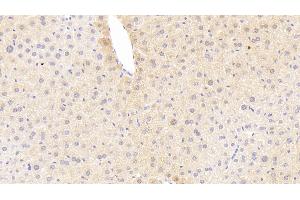 Detection of TREM1 in Mouse Liver Tissue using Polyclonal Antibody to Triggering Receptor Expressed On Myeloid Cells 1 (TREM1) (TREM1 antibody  (AA 21-230))
