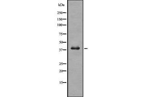 Western blot analysis of TRIB3 using COLO205 whole  lysates. (TRIB3 antibody  (N-Term))