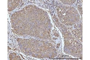 IHC analysis of OCRL using anti-OCRL antibody (ABIN7599572). (OCRL antibody  (AA 1-901))
