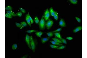 Immunofluorescence staining of Hela cells with ABIN7154344 at 1:66, counter-stained with DAPI. (PIGV antibody  (AA 400-469))