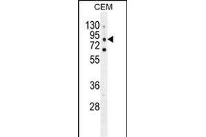 CLCN7 Antibody (C-term) (ABIN655808 and ABIN2845235) western blot analysis in CEM cell line lysates (35 μg/lane). (CLCN7 antibody  (C-Term))