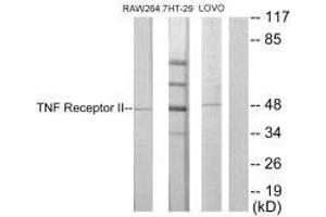 Western blot analysis of extracts from RAW264. (TNFRSF1B antibody  (C-Term))