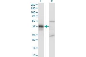 Western Blot analysis of DLX3 expression in transfected 293T cell line by DLX3 monoclonal antibody (M02), clone 3B8.