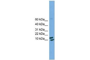 PPIH antibody used at 1 ug/ml to detect target protein.