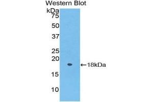 Detection of Recombinant POSTN, Rat using Polyclonal Antibody to Periostin (POSTN) (Periostin antibody  (AA 24-173))