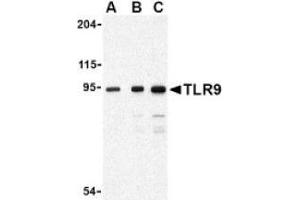 Image no. 1 for anti-Toll-Like Receptor 9 (TLR9) antibody (ABIN951281) (TLR9 antibody)
