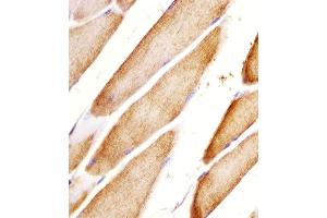 (ABIN6243464 and ABIN6578057) staining Htr2a in mouse skeletal muscle sections by Immunohistochemistry (IHC-P - paraformaldehyde-fixed, paraffin-embedded sections). (HTR2A antibody  (N-Term))