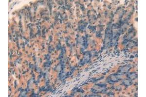 IHC-P analysis of Mouse Stomach Tissue, with DAB staining. (SERPINA7 antibody  (AA 127-393))
