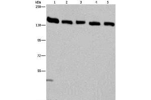 Western Blot analysis of Hela cell and Human testis tissue, A549, Jurkat and K562 cell using IPO4 Polyclonal Antibody at dilution of 1:550 (Importin 4 antibody)