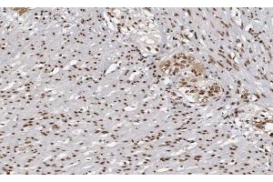 ABIN6266862 at 1/100 staining human Smooth muscle tissue sections by IHC-P. (MAPKAP Kinase 3 antibody  (C-Term))