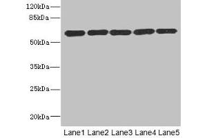 Western blot All lanes: ARHGEF3 antibody at 2. (ARHGEF3 antibody  (AA 287-526))