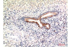 Immunohistochemistry (IHC) analysis of paraffin-embedded Human Liver, antibody was diluted at 1:100. (Complement C4A/C4B (Internal Region) antibody)