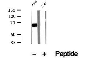Western blot analysis of extracts of A549 cells, using Syndecan-3 antibody.