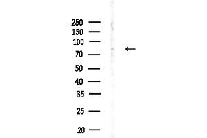 anti-Cytochrome C Oxidase Subunit I (COX1) (C-Term) antibody