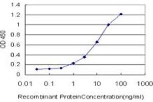 Detection limit for recombinant GST tagged HGD is approximately 0. (HGD antibody  (AA 377-445))