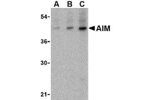 Image no. 1 for anti-CD5 Molecule-Like (CD5L) (C-Term) antibody (ABIN265124) (CD5L antibody  (C-Term))