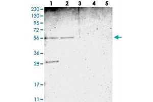 Western blot analysis of Lane 1: RT-4, Lane 2: U-251 MG, Lane 3: Human Plasma, Lane 4: Liver, Lane 5: Tonsil with TMEM180 polyclonal antibody  at 1:250-1:500 dilution. (TMEM180 antibody)
