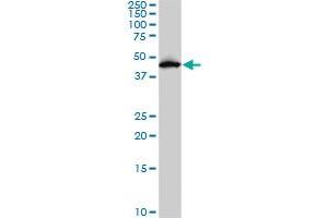 PDK2 monoclonal antibody (M02), clone 5F8. (PDK2 antibody  (AA 187-276))