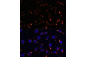 Immunofluorescence analysis of L929 cells using NOS1 antibody (ABIN6129512, ABIN6144725, ABIN6144726 and ABIN6216548) at dilution of 1:100. (NOS1 antibody  (AA 1-180))