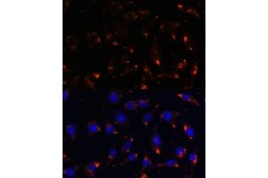 Immunofluorescence analysis of L929 cells using NOS1 antibody (ABIN6129512, ABIN6144725, ABIN6144726 and ABIN6216548) at dilution of 1:100. (NOS1 antibody  (AA 1-180))