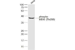 Hela lysates probed with MEK1 (Thr286) Polyclonal Antibody, Unconjugated  at 1:300 dilution and 4˚C overnight incubation. (MEK1 antibody  (pThr286))
