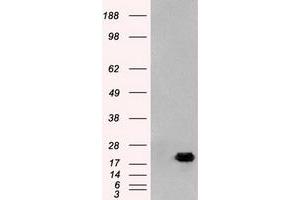 Image no. 1 for anti-Adenylate Kinase 1 (AK1) antibody (ABIN1496516) (Adenylate Kinase 1 antibody)