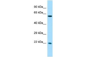 Host: Rabbit Target Name: CCDC85A Sample Type: Fetal Liver lysates Antibody Dilution: 1. (CCDC85A antibody  (N-Term))