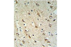 Formalin fixed and paraffin embedded human brain tissue reacted with DNAJC6 Antibody  followed by peroxidase conjugation of the secondary antibody and DAB staining. (DNAJC6 antibody  (Middle Region))