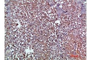 Immunohistochemical analysis of paraffin-embedded human-pancreas, antibody was diluted at 1:200 (CCL2 antibody  (AA 31-80))