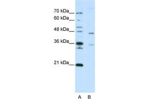Western Blotting (WB) image for anti-Zinc Finger Protein 488 (ZNF488) antibody (ABIN2462000)