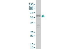 Western Blotting (WB) image for anti-CAMP Responsive Element Binding Protein 5 (CREB5) (AA 1-100) antibody (ABIN599087) (CREB5 antibody  (AA 1-100))