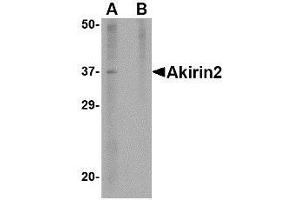 Western blot analysis of Akirin2 in mouse brain tissue lysate with AP30040PU-N Akirin2 antibody at 1 μg/ml in (A) the absence and (B) the presence of blocking peptide. (AKIRIN2 antibody  (Center))