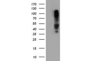 Image no. 1 for anti-serpin Peptidase Inhibitor, Clade B (Ovalbumin), Member 1 (SERPINB1) (AA 77-306) antibody (ABIN1491672)