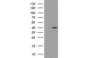 HEK293T cells were transfected with the pCMV6-ENTRY control (Left lane) or pCMV6-ENTRY DHPS (Right lane) cDNA for 48 hrs and lysed. (DHPS antibody)