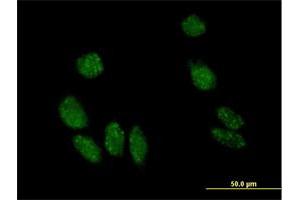 Immunofluorescence of purified MaxPab antibody to MYL5 on HeLa cell. (MYL5 antibody  (AA 1-173))