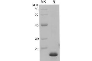 Western Blotting (WB) image for S100 Calcium Binding Protein A9 (S100A9) (Active) protein (His tag) (ABIN7320928) (S100A9 Protein (His tag))