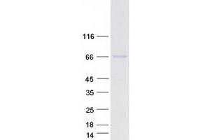 Validation with Western Blot (CFHR5 Protein (Myc-DYKDDDDK Tag))