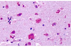 Anti-GPR83 antibody IHC staining of human brain, cortex, neurons. (GPR83 antibody  (Extracellular Domain))