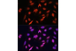 Immunofluorescence analysis of U2OS cells using OTUB1 antibody (ABIN6128400, ABIN6145086, ABIN6145088 and ABIN6215346) at dilution of 1:100. (OTUB1 antibody  (AA 1-220))