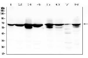 Western blot analysis of LBR using anti-LBR antibody (ABIN6719340).