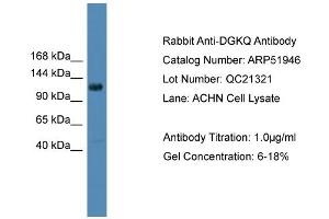 WB Suggested Anti-DGKQ  Antibody Titration: 0. (DGKQ antibody  (Middle Region))