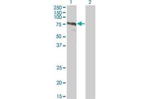 Western Blot analysis of ZYX expression in transfected 293T cell line by ZYX monoclonal antibody (M01), clone 2C10-4A7. (ZYX antibody  (AA 1-572))