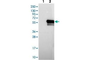 Western blot analysis of Lane 1: Negative control (vector only transfected HEK293T lysate), Lane 2: Over-expression Lysate (Co-expressed with a C-terminal myc-DDK tag (~3. (KIAA1609 antibody)
